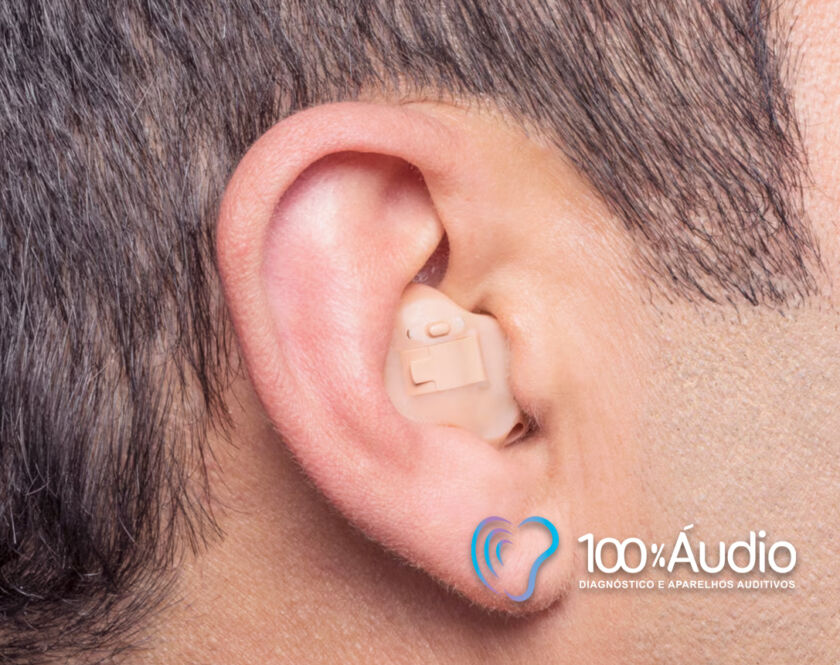 100porcentoaudiophonakblog1-840x665